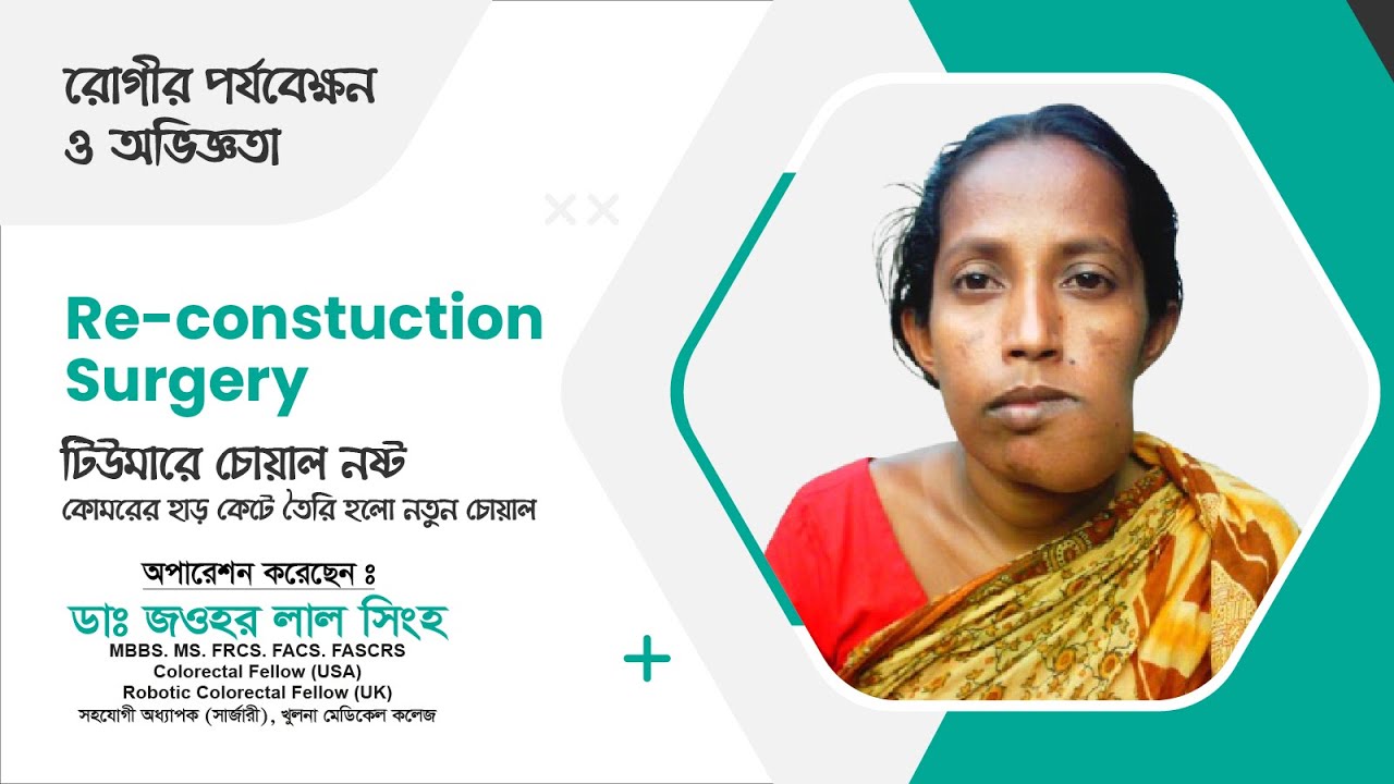 টিউমারে চোয়াল নষ্ট — কোমরের হাড় কেটে তৈরি হলো নতুন চোয়াল | Reconstruction | Dr. Jawhar Lal Singha