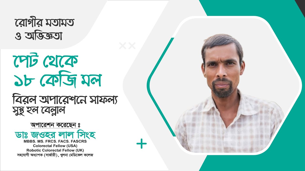 বিরল সার্জারি: পেট থেকে ১৮ কেজি মল বের করলেন ডা. জওহর লাল সিংহ
