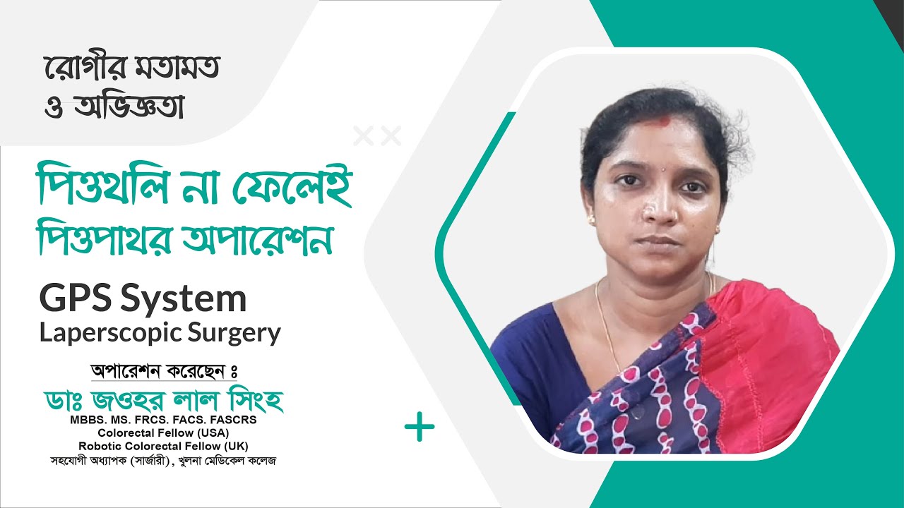পিত্তথলি না ফেলে পিত্তপাথর অপারেশন | GPS System Laparoscopic Surgery | Dr. Jawhar Lal Singha